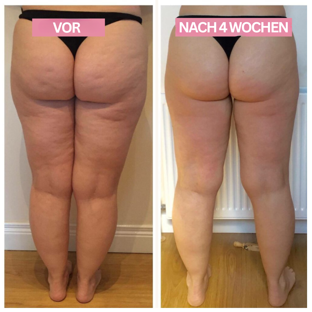 "Anti-Cellulite-Cupping-Gerät für effektive Hautstraffung, kompakt, tragbar, mit Cupping, Schaben und Infrarotfunktion"