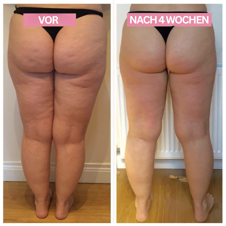 "Anti-Cellulite-Cupping-Gerät für effektive Hautstraffung, kompakt, tragbar, mit Cupping, Schaben und Infrarotfunktion"