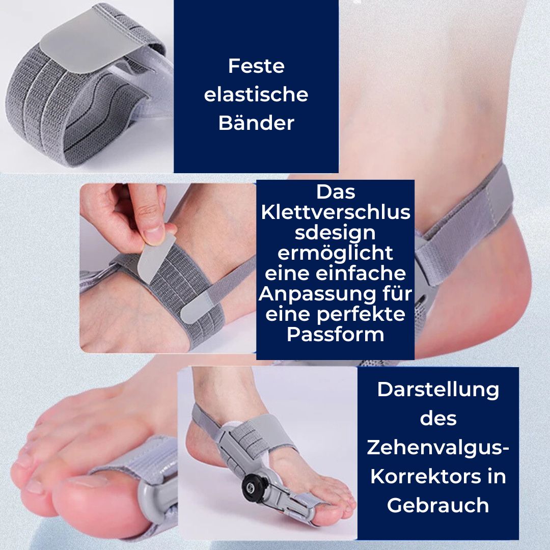 "Beige Hallux Valgus Entlastungsstütze mit Zehentrenner und verstellbarer Passform für Schmerzreduktion und Komfort"
