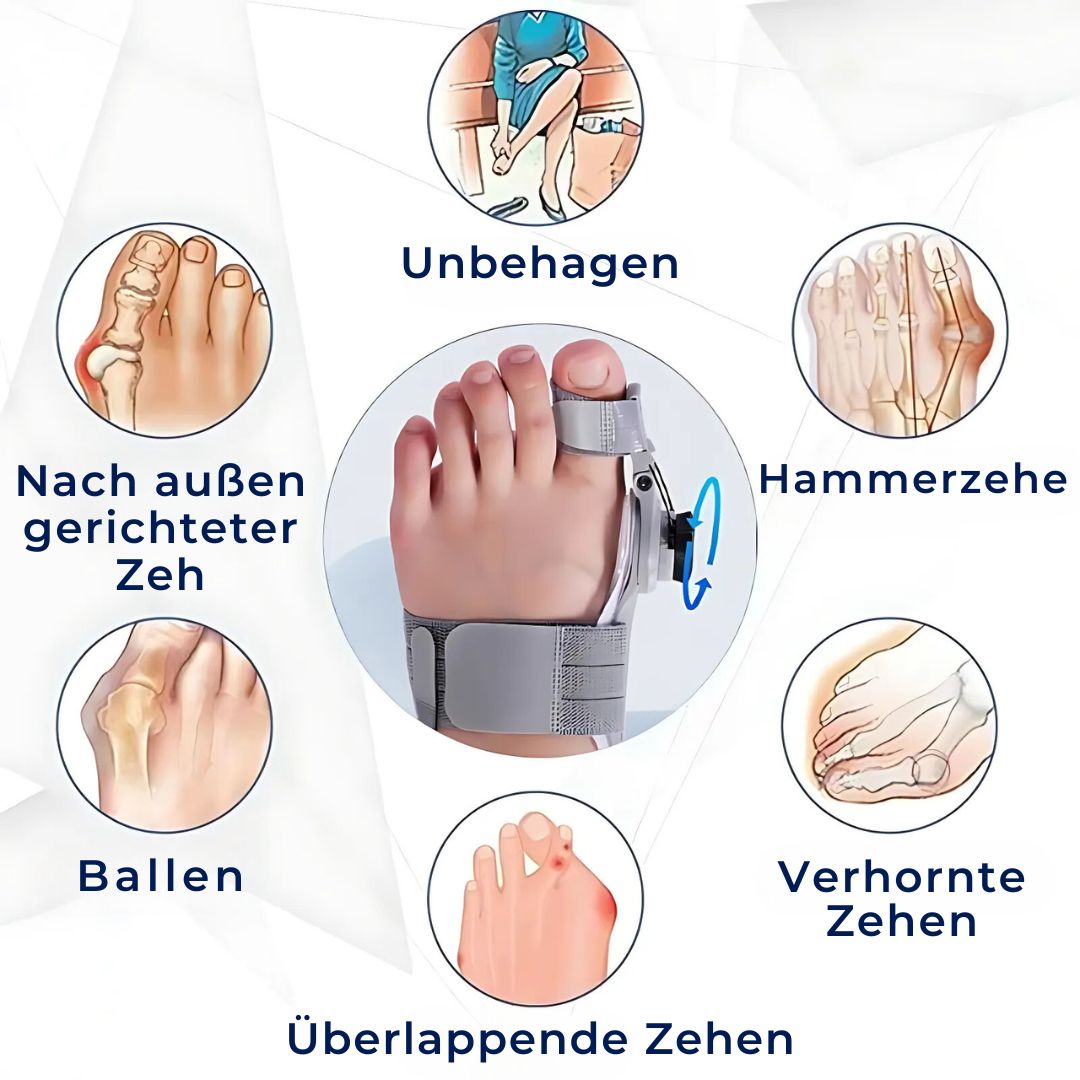 "Beige Hallux Valgus Entlastungsstütze mit Zehentrenner und verstellbarer Passform für Schmerzreduktion und Komfort"
