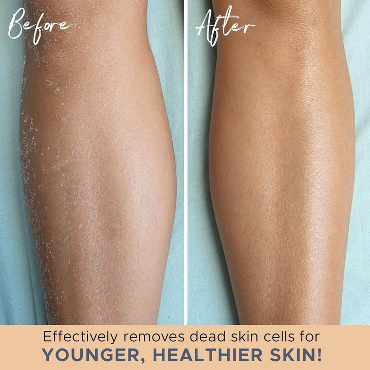 Exfoliierende Badehandschuhe für Dusche & Peeling