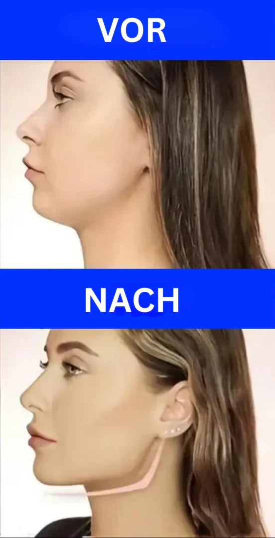 Kompakter Kiefertrainer aus Silikon, der mit Zubehör geliefert wird, ideal für gezielte Muskelaktivierung und Gesichtskonture