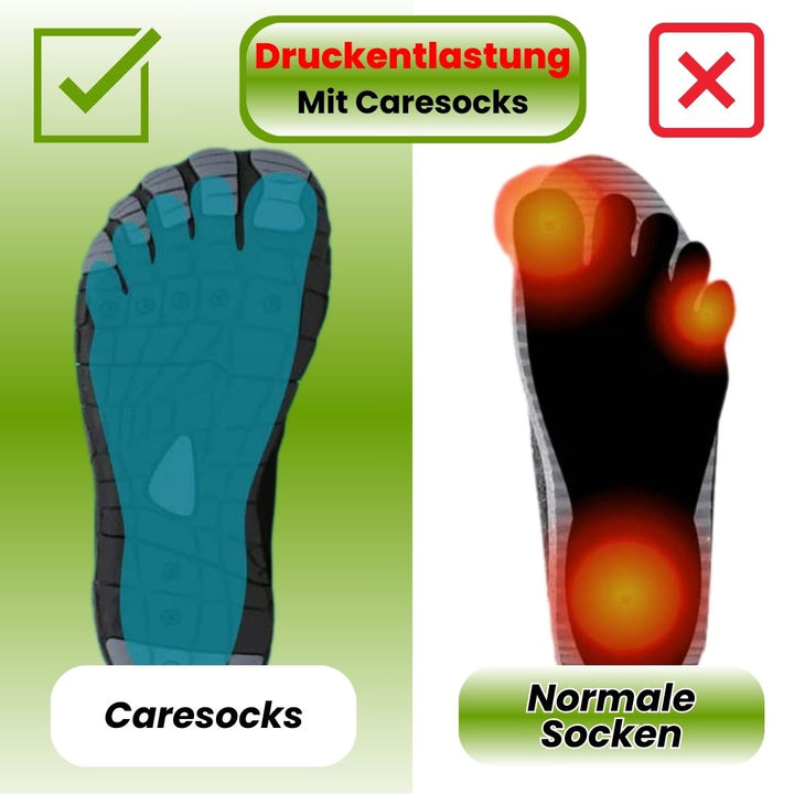 Orthopädische Kompressionsstrümpfe in hautfarbenem Design, fördern Durchblutung und lindern Fußbeschwerden effektiv.