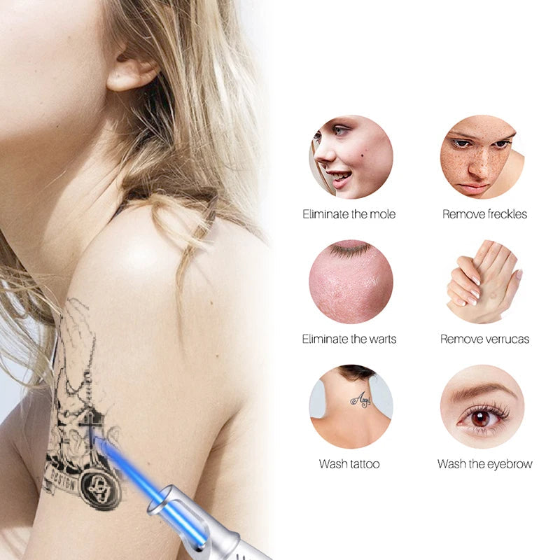 Freckle remover & pigmentation treatment laser pen for clear, rejuvenated skin. Home laser beauty tool.
